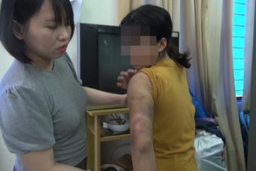 Vụ cứu 8 thiếu nữ trong "động quỷ”: Bị tra tấn, chích điện rất dã man!